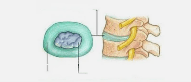 Art der Osteochondrose